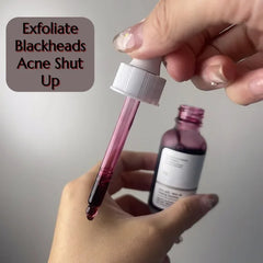 Niacinamide 10% + Zinc 1% Serum (Original)